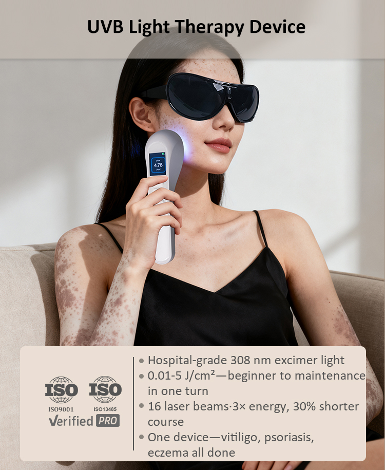 Home UVB Light Therapy Device
