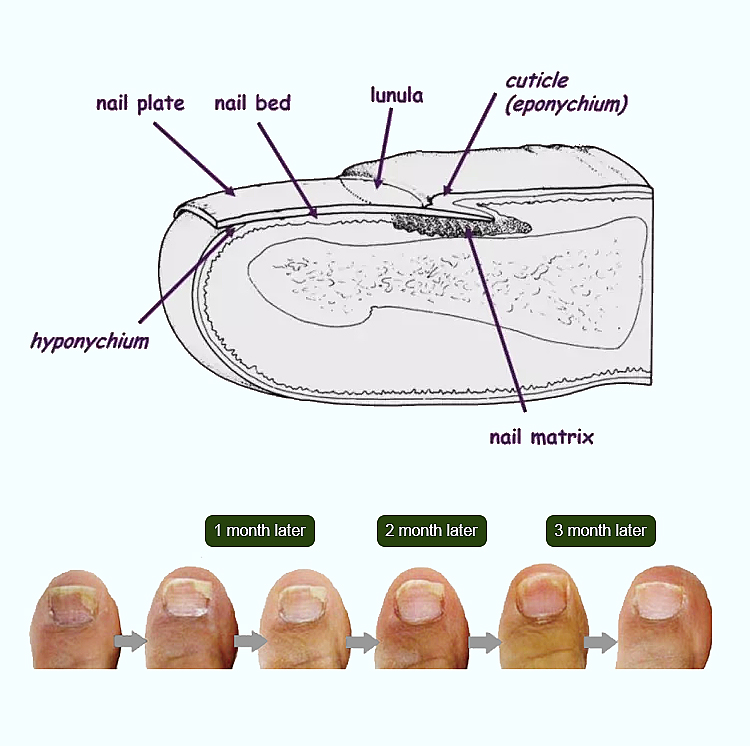 HZJ-02 Nail Fungus Cold Laser Therapy Device (3)