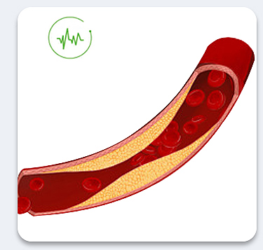 4-color laser watch treatment principle (1)