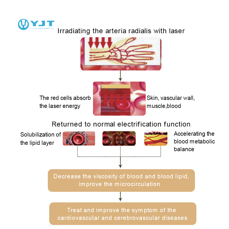 YJT Wearable LLLT Laser Therapy Watch | Hypertension, Cholesterol & Diabetes Management Device