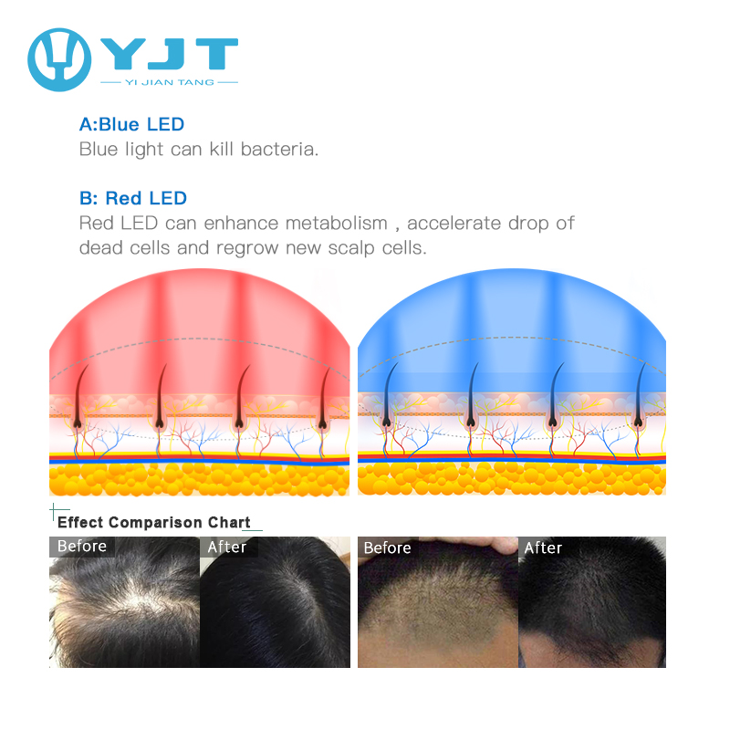 Red Light Therapy Helmet Hair Growth and Hair Loss Treatment Machine